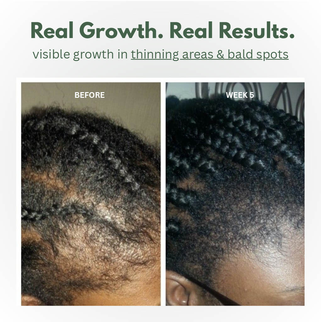 Scalp Stimulator