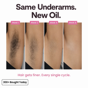 Anti-Hair Growth Oil