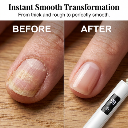 Professional Electric Nail Polisher – Smooths thick nails. 99-speed display. Multiple heads for shaping & buffing. Salon at home! 🌟💎